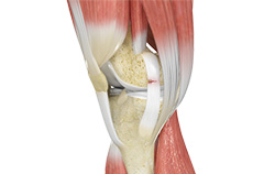 Ligament Injuries